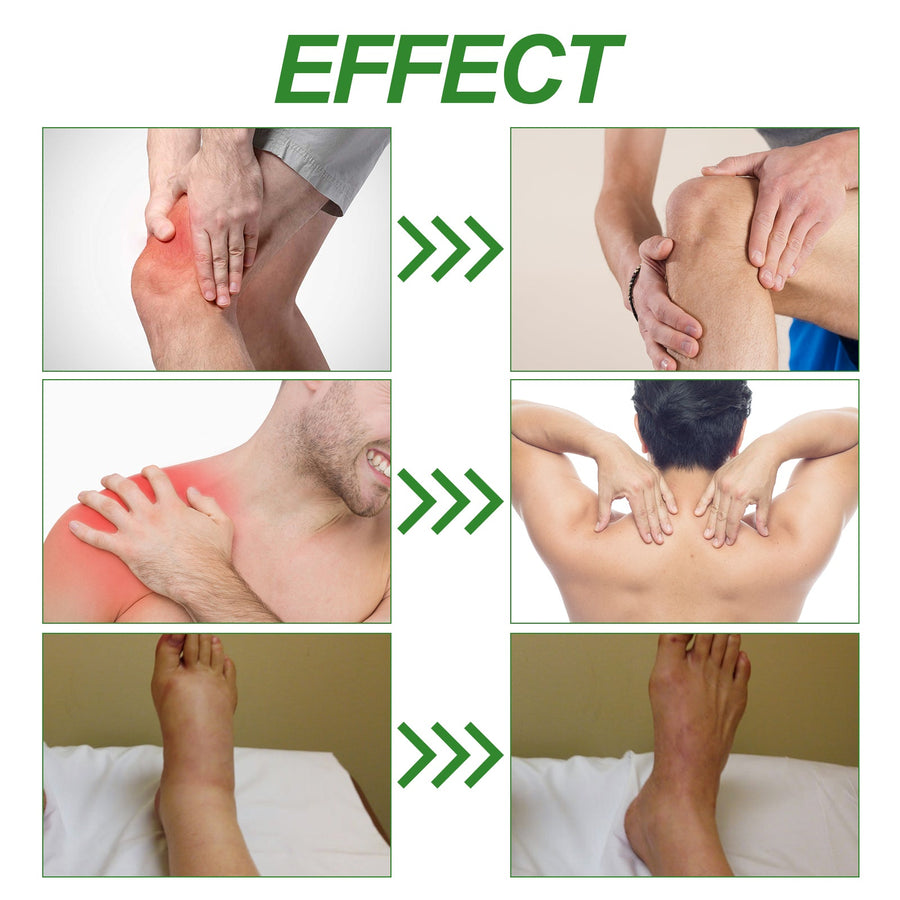 Joint Care Cream with Bee Venom — Natural Pain Relief