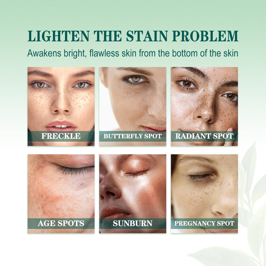 Brightening Blemish Essence for Dark Spots & Melasma