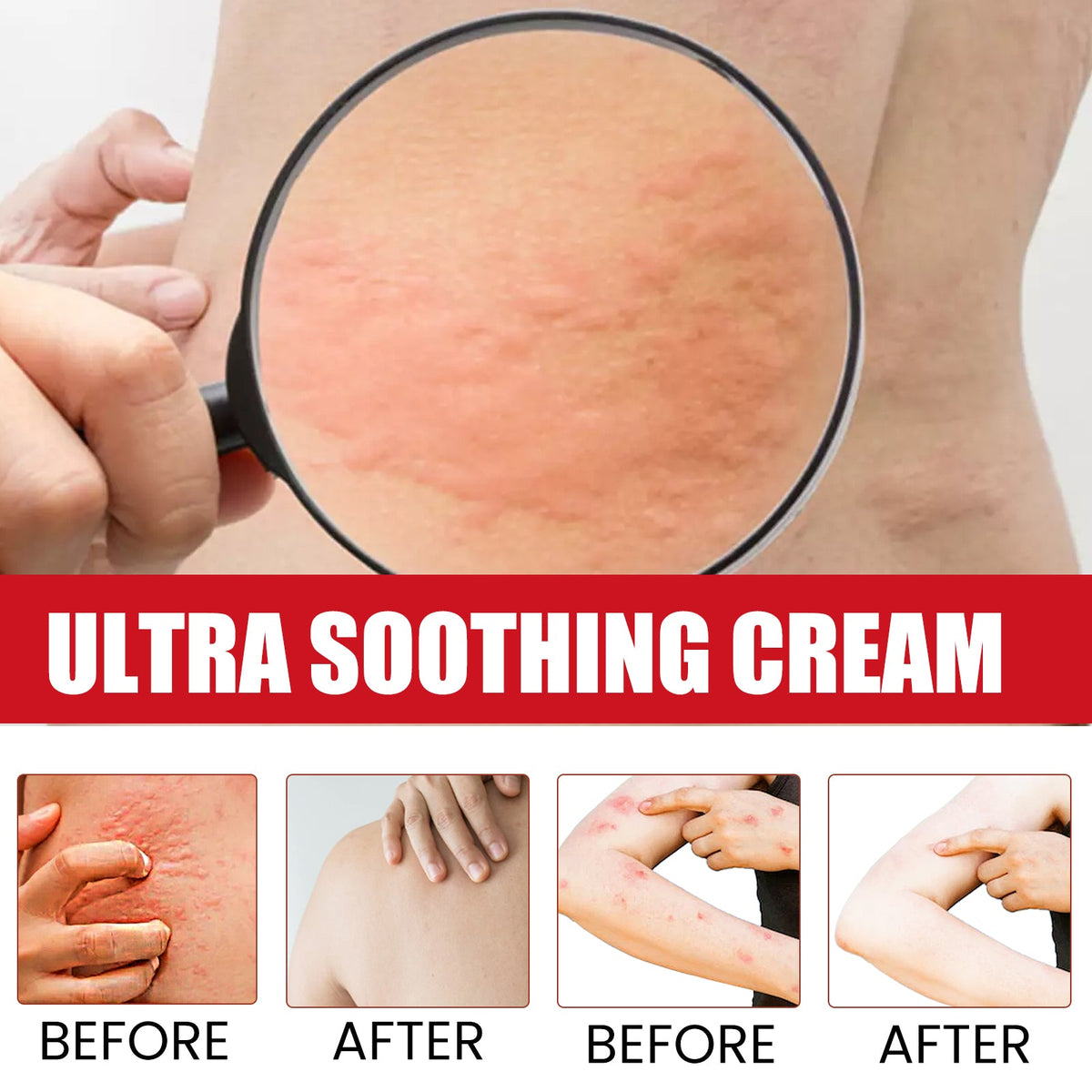 Ultra Soothing Cream for Bug Bites & Itchy Rash Relief