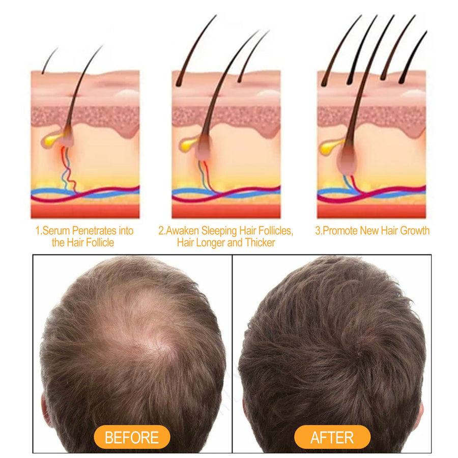 Ginger Hair Serum for Moisture & Fuller-Looking Roots