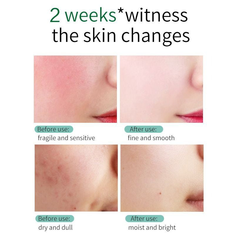 Centella Repair Face Cream for Sensitive, Dry Skin