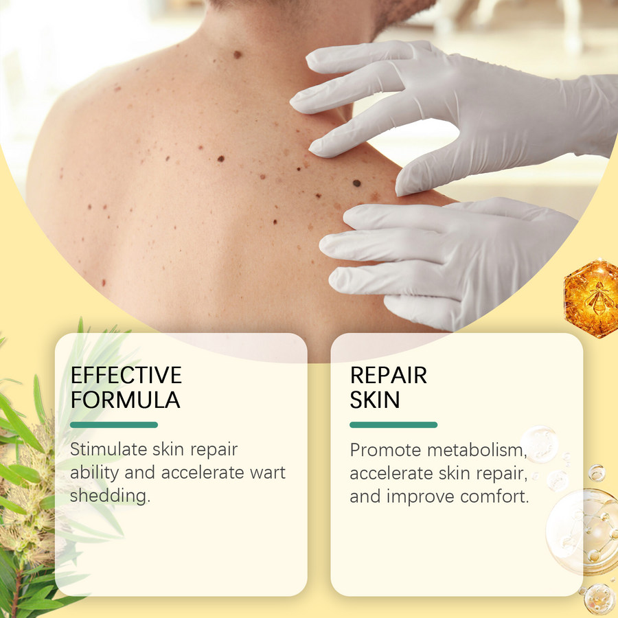 Bee Venom Wart & Mole Removal Spray, Gentle Cleansing Skin M