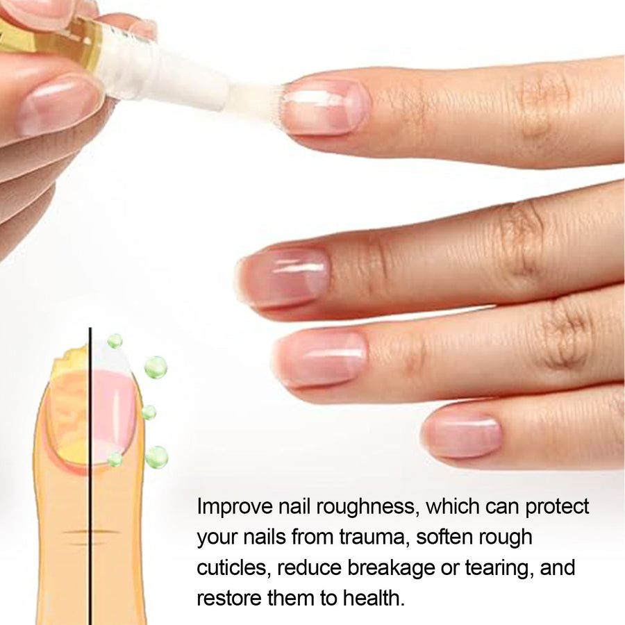 Cuticle Oil Pen — Repair Rough Nails & Soften Cuticles Fast