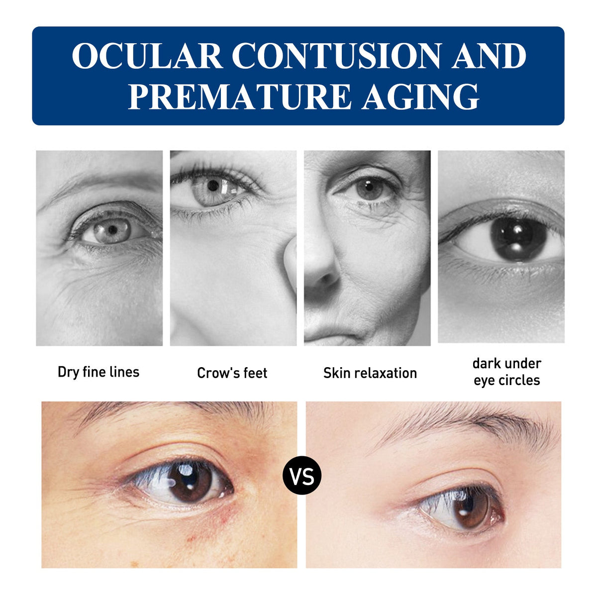 Collagen Eye Cream for Dark Circles & Eye Bags