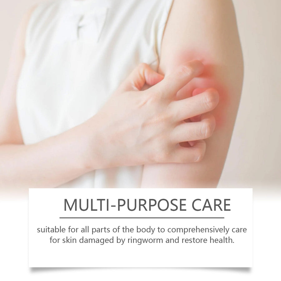 Herbal Antifungal Cream for Athlete's Foot & Tinea Relief