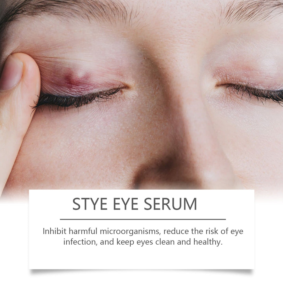 Herbal Eye Drops for Redness, Swelling & Itching Relief