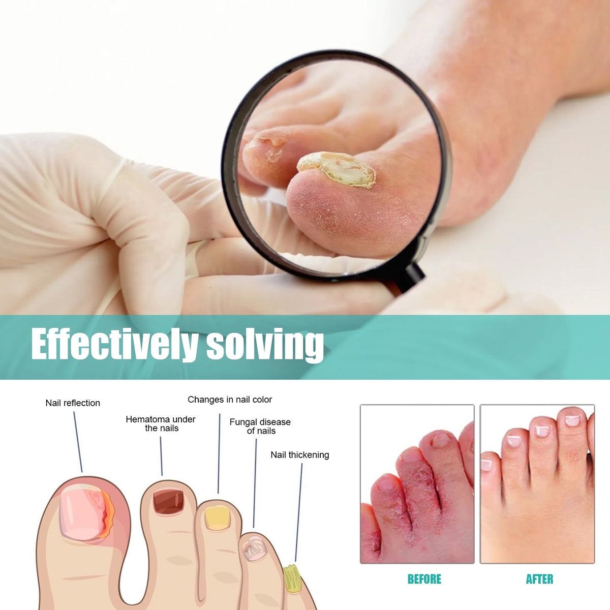 Natural Toenail Care Spray, Gentle