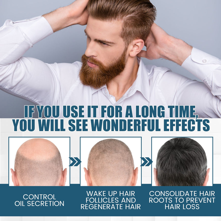 Hair Essence Spray — Visible Hair Density Restoration in 8