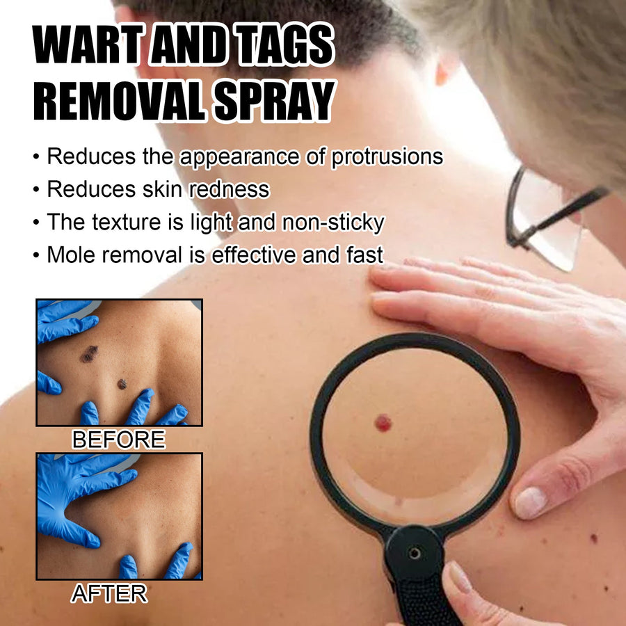 Skin Tag & Blemish Spray with Bee Venom Complex