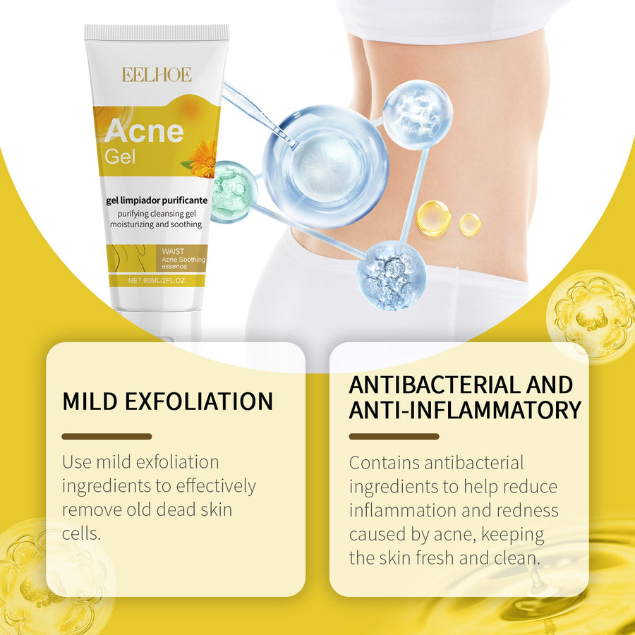 Body Acne Gel — Clear Breakouts with Calendula & Aloe