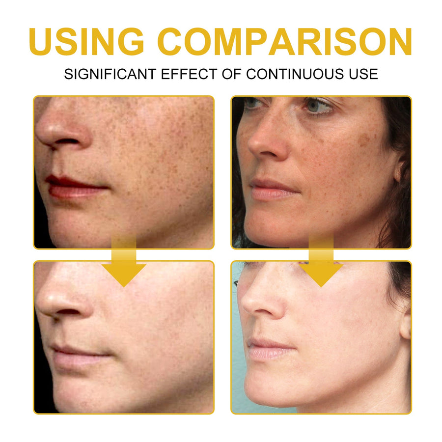 Wiyun V7 Cream Fades Dullness, Wrinkles & Uneven Tone