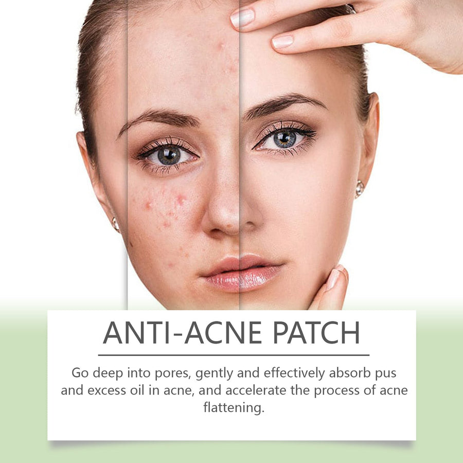 Anti-Acne Patches - Gentle Herbal Blemish Spot Treatment