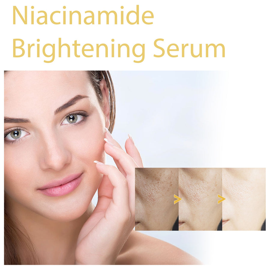 Niacinamide Serum for Dark Spots & Dull, Uneven Skin