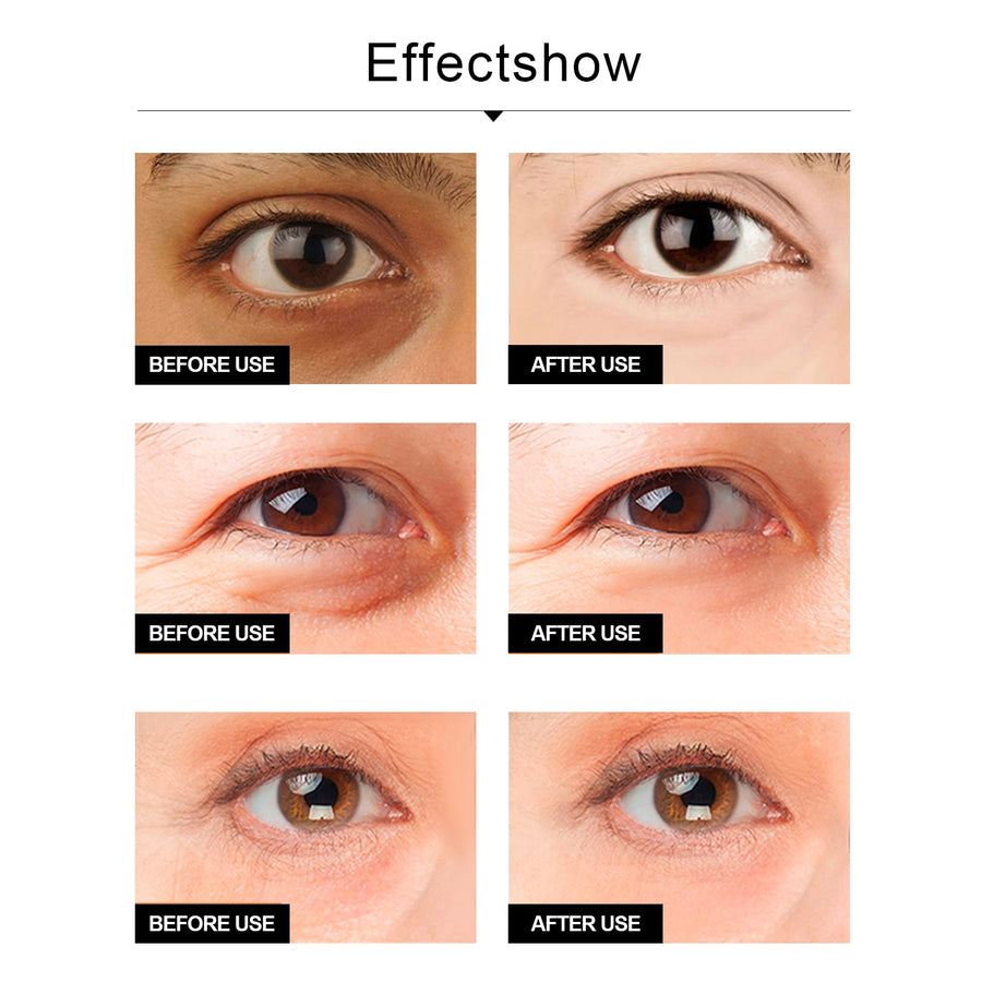 Snake Venom Eye Cream – Reduces Dark Circles & Fine Lines