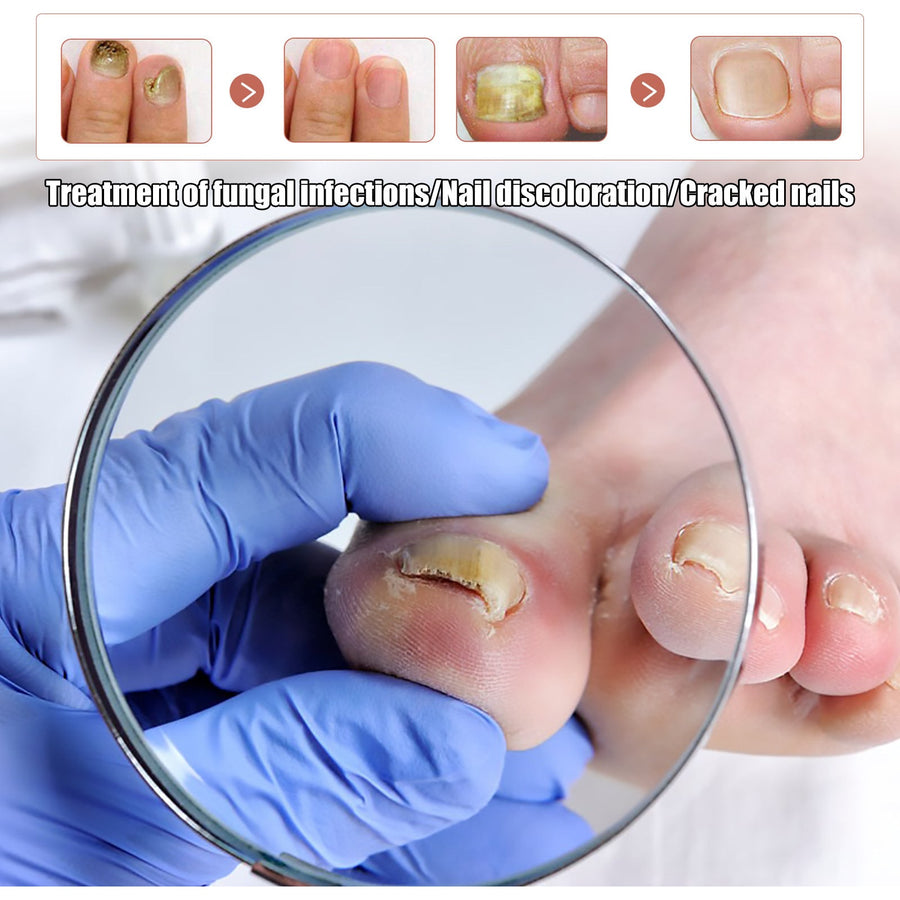 Natural Anti-Fungal Foot Soak Tablets for Nail Repair