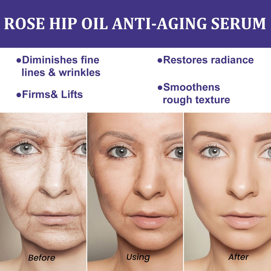Rose Hip Oil Face Essence for Fine Lines & Dullness