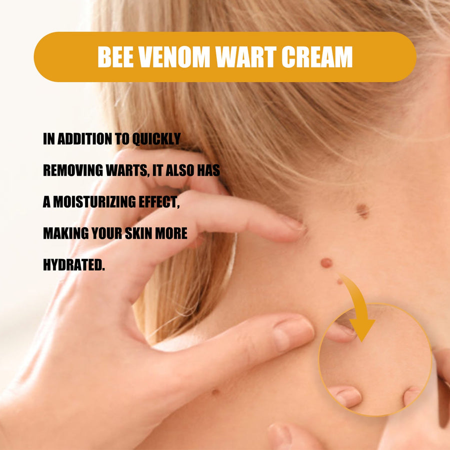 Bee Venom Wart Cream for Stubborn Hand & Foot Warts