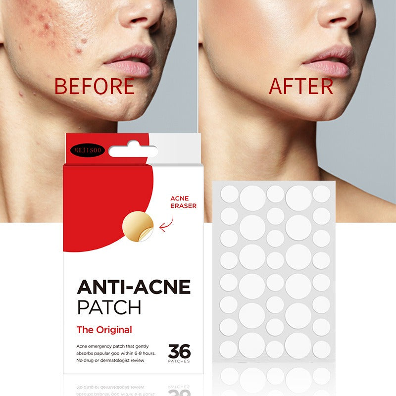 Acne Patches: Invisible Blemish Protection Overnight