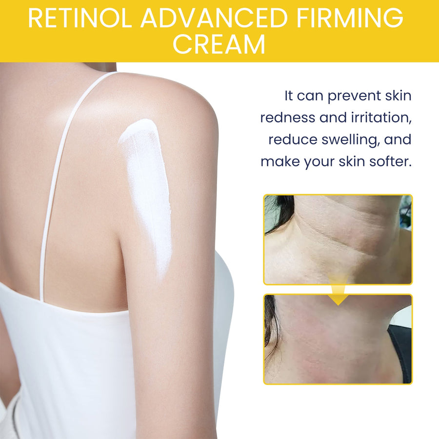 Retinol Firming Body Cream for Crepey Sagging Skin