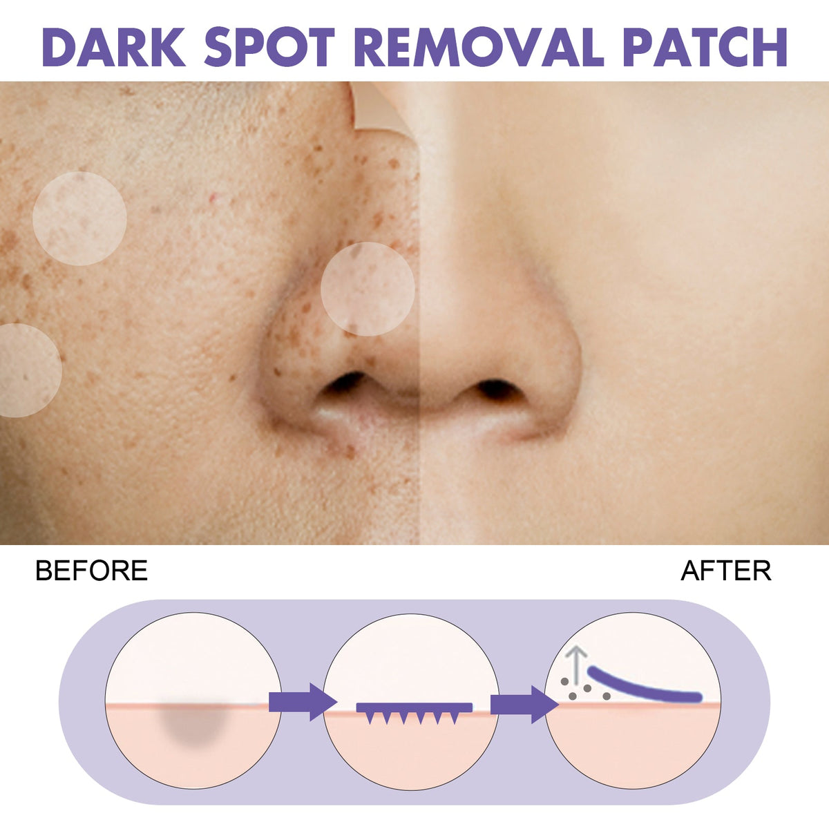 Dark Spot Patches for Melasma & Age Spots, 144-Pack