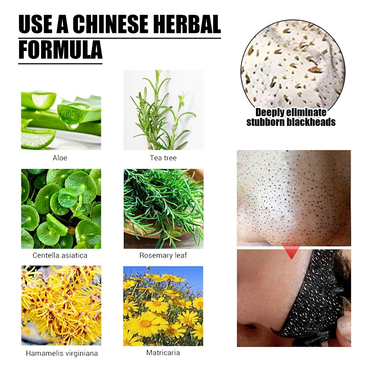 Blackhead Removal Mask — Activated Charcoal Peel‑Off Deep