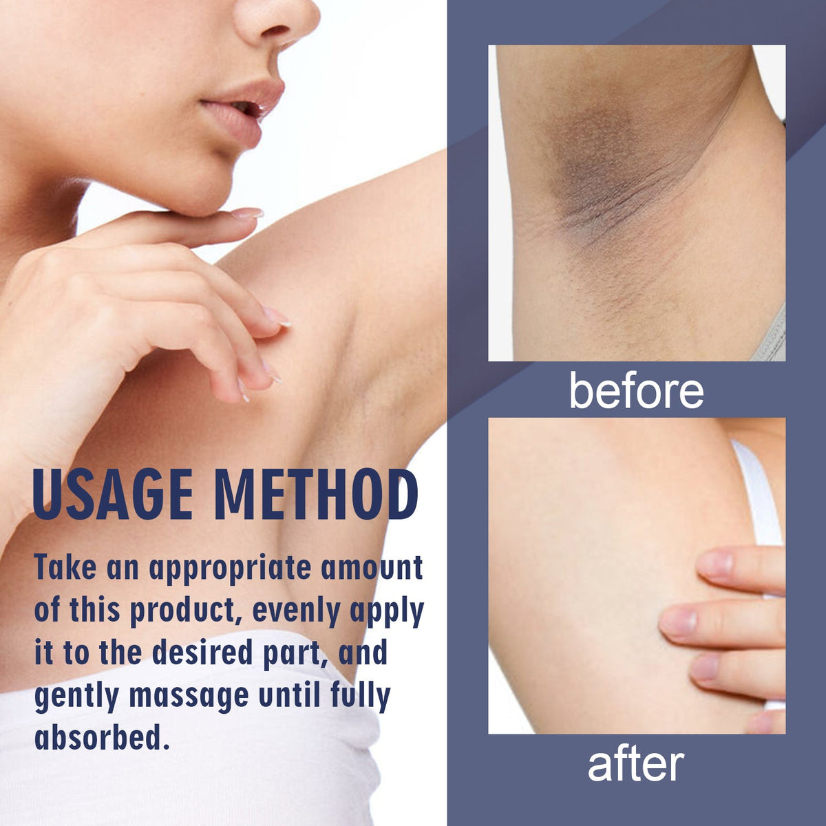 Underarm Whitening Cream — Brighter Skin in 7–30 Days