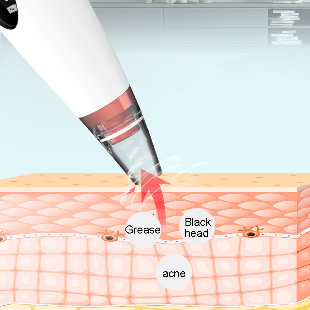 6‑in‑1 Electric Blackhead Remover — Won’t Damage Skin, 3 Modes