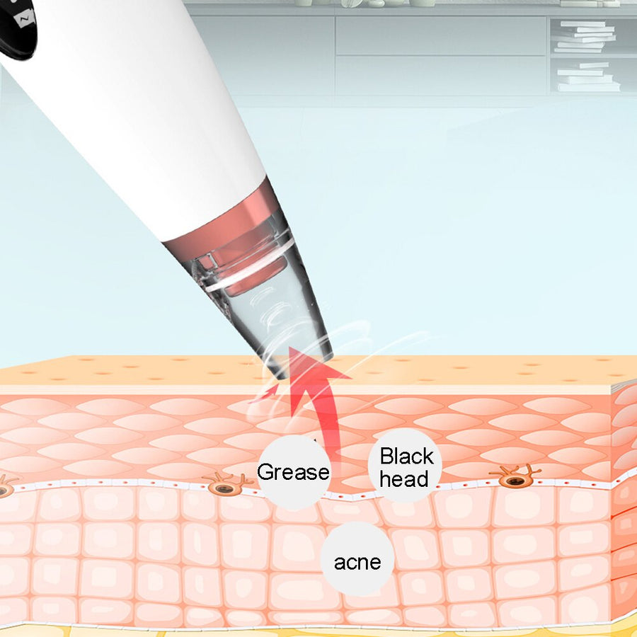 6‑in‑1 Electric Blackhead Remover — Won’t Damage Skin, 3 Modes