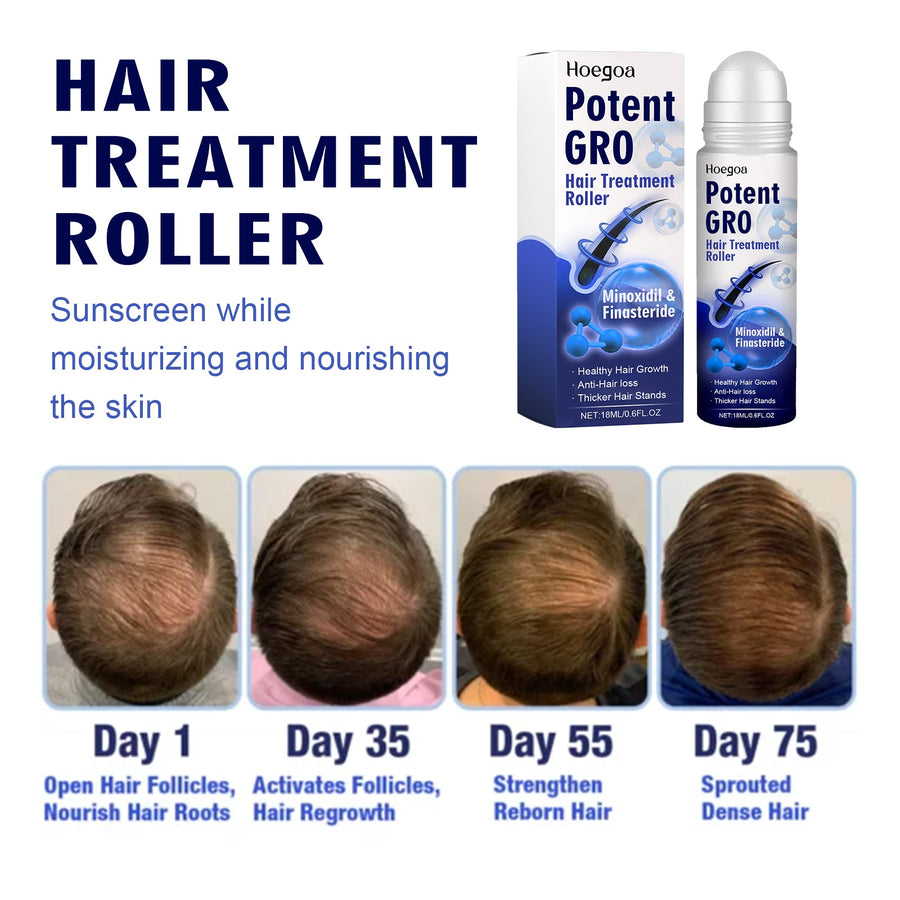 Hair Growth Roller — Minoxidil & Finasteride for Denser Hair