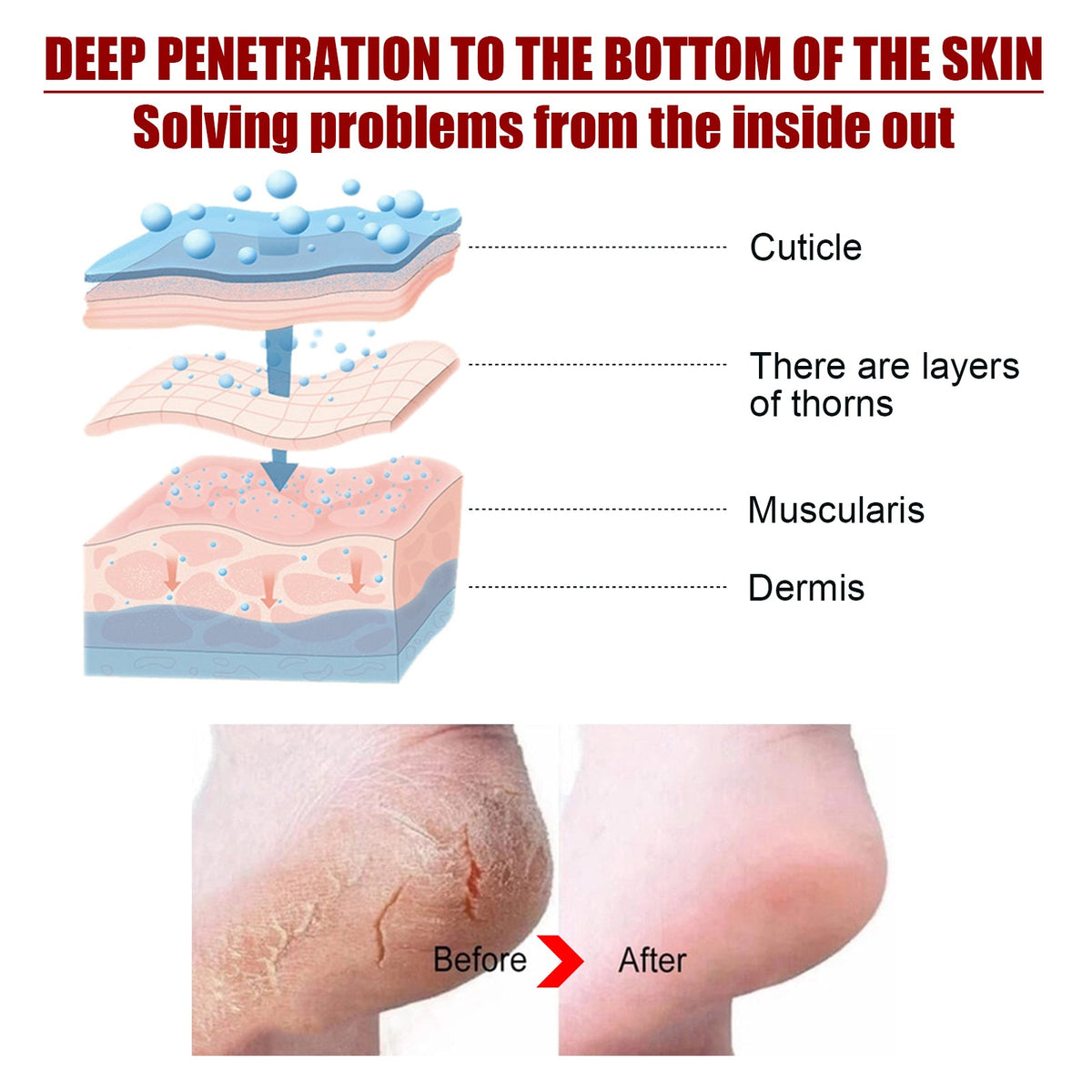 Exfoliating Foot Peel Mask for Soft Smooth Feet Fast