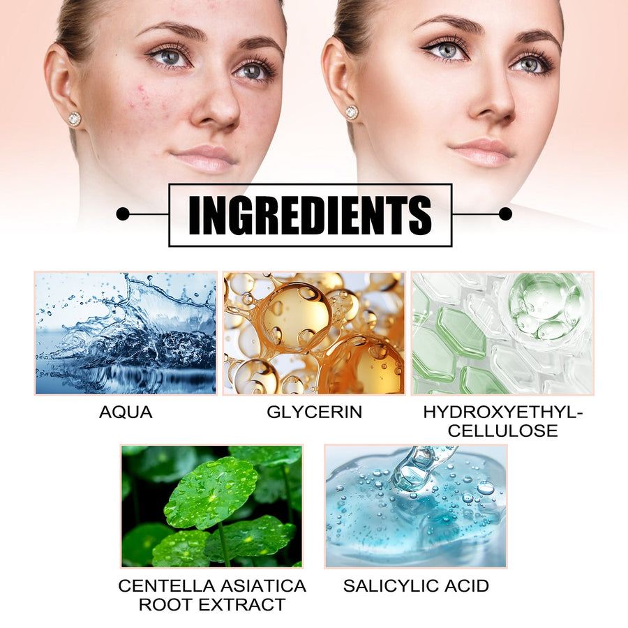 Acne Spot Patches — Treat All Pimples Invisibly, Day & Night