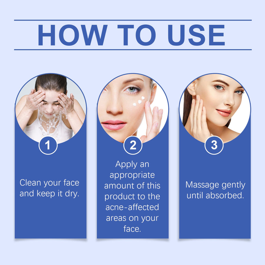 Acne Clearing Cream for Oily, Blemish-Prone Skin