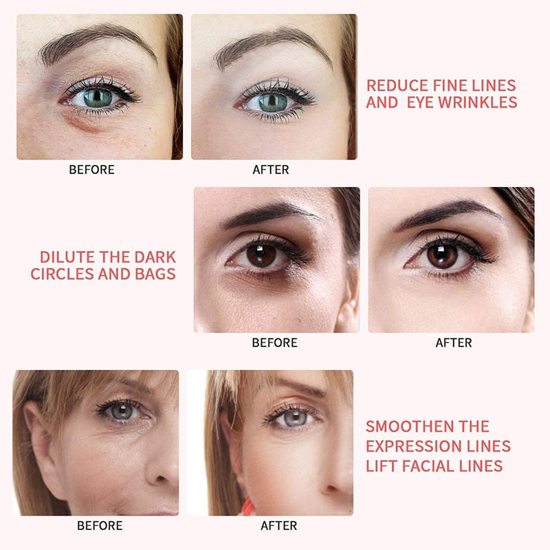5-in-1 Facial Beauty Device for Cleansing & Firming