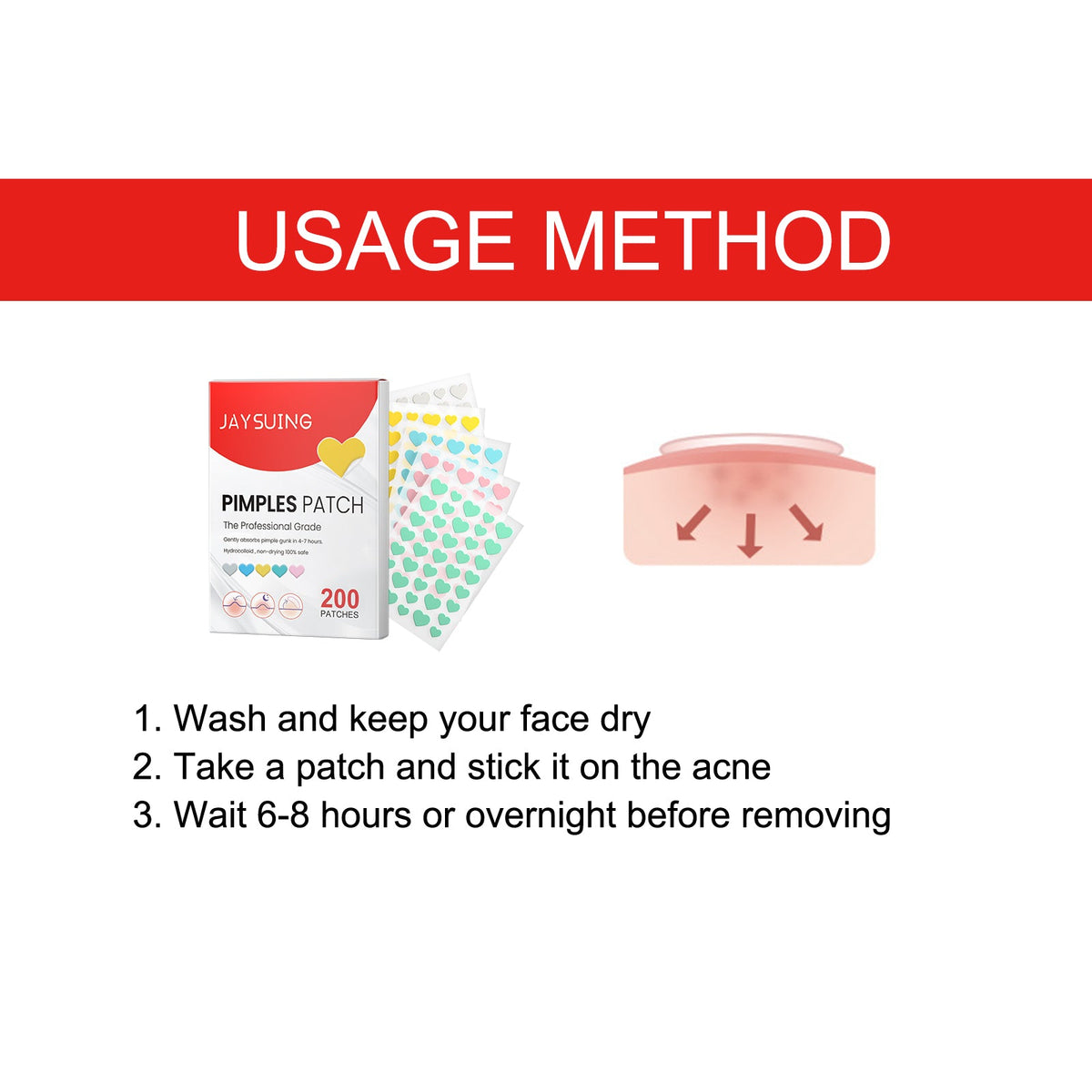 Hydrocolloid Acne Patches for Gentle Blemish Coverage