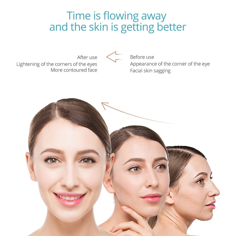 RF EMS LED Facial Device for At-Home Skin Lifting