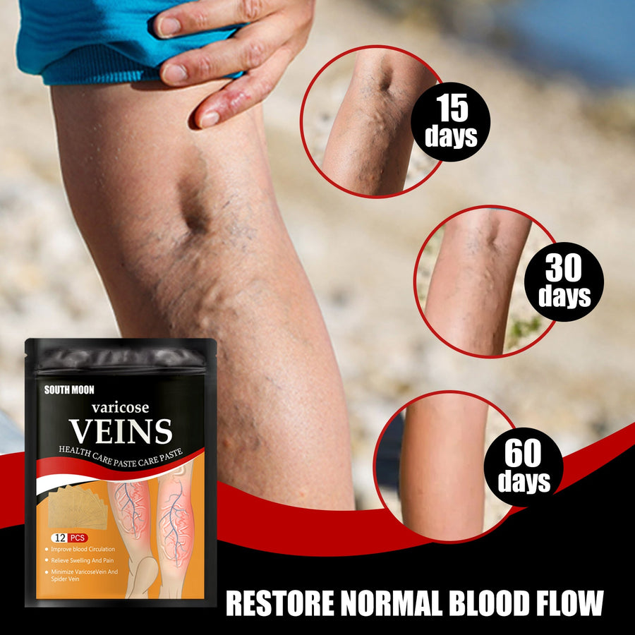 Varicose Vein Relief Patches — Visibly Reduce Swollen Veins