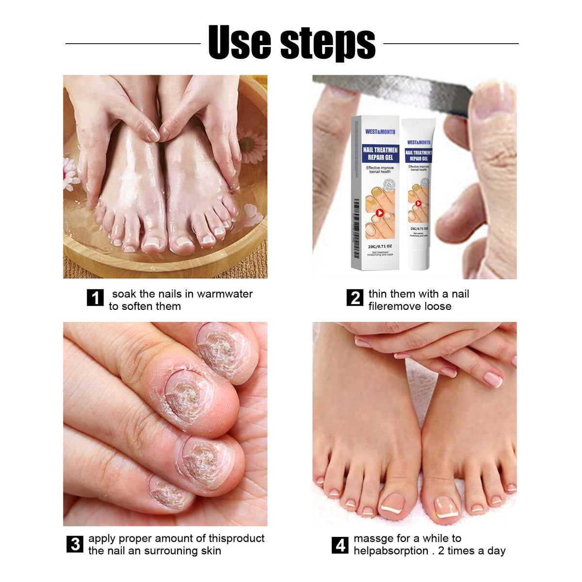 Nail Repair Gel for Damaged, Discolored Toenails