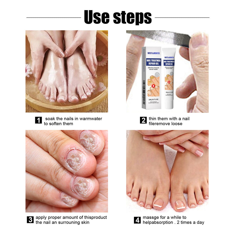 Nail Repair Gel for Damaged, Discolored Toenails