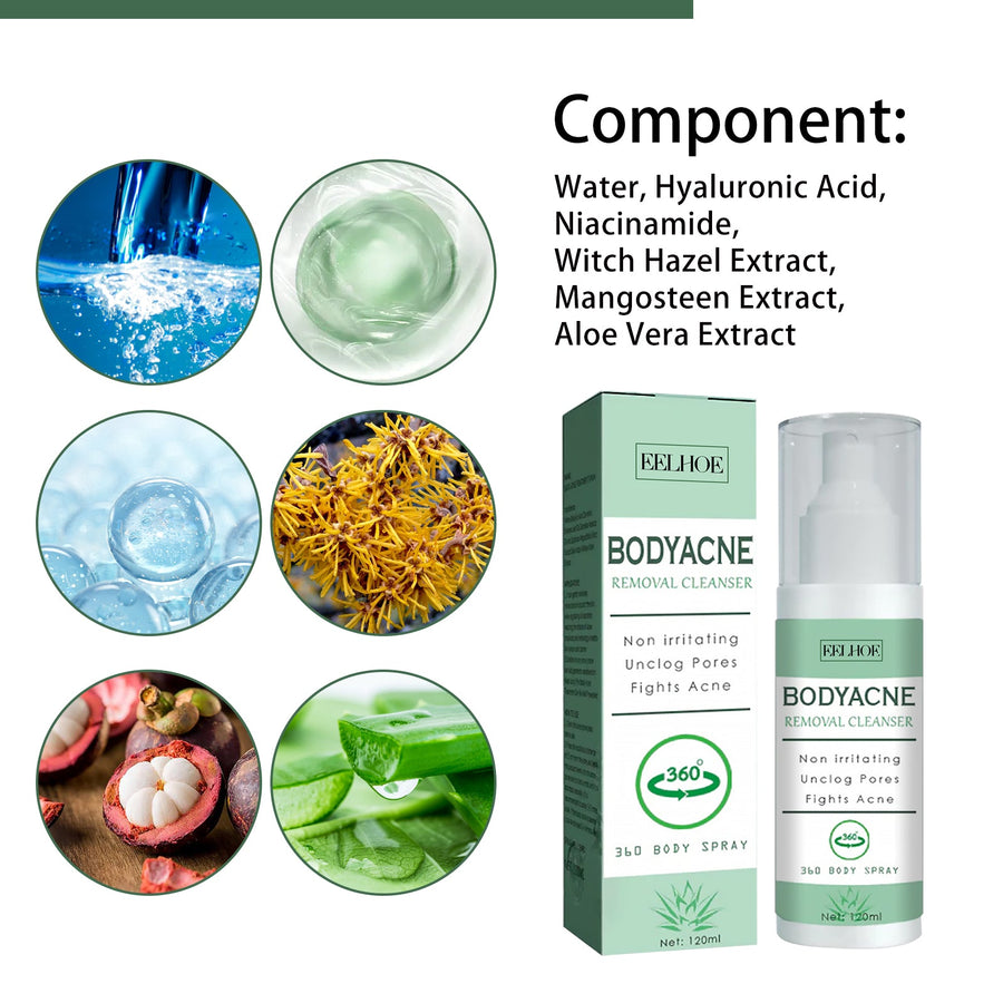 Body Acne Spray for Back, Chest & Shoulder Breakouts