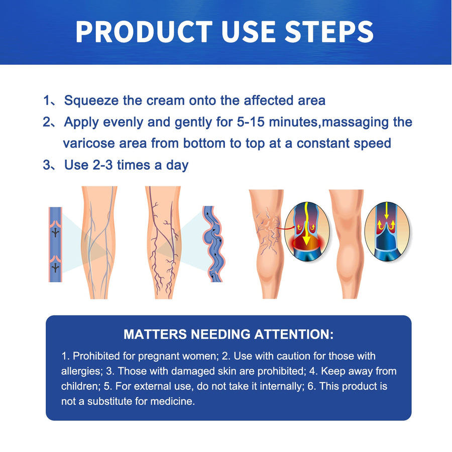 Varicose Vein Cream — Visible Vein Reduction in 2 Weeks
