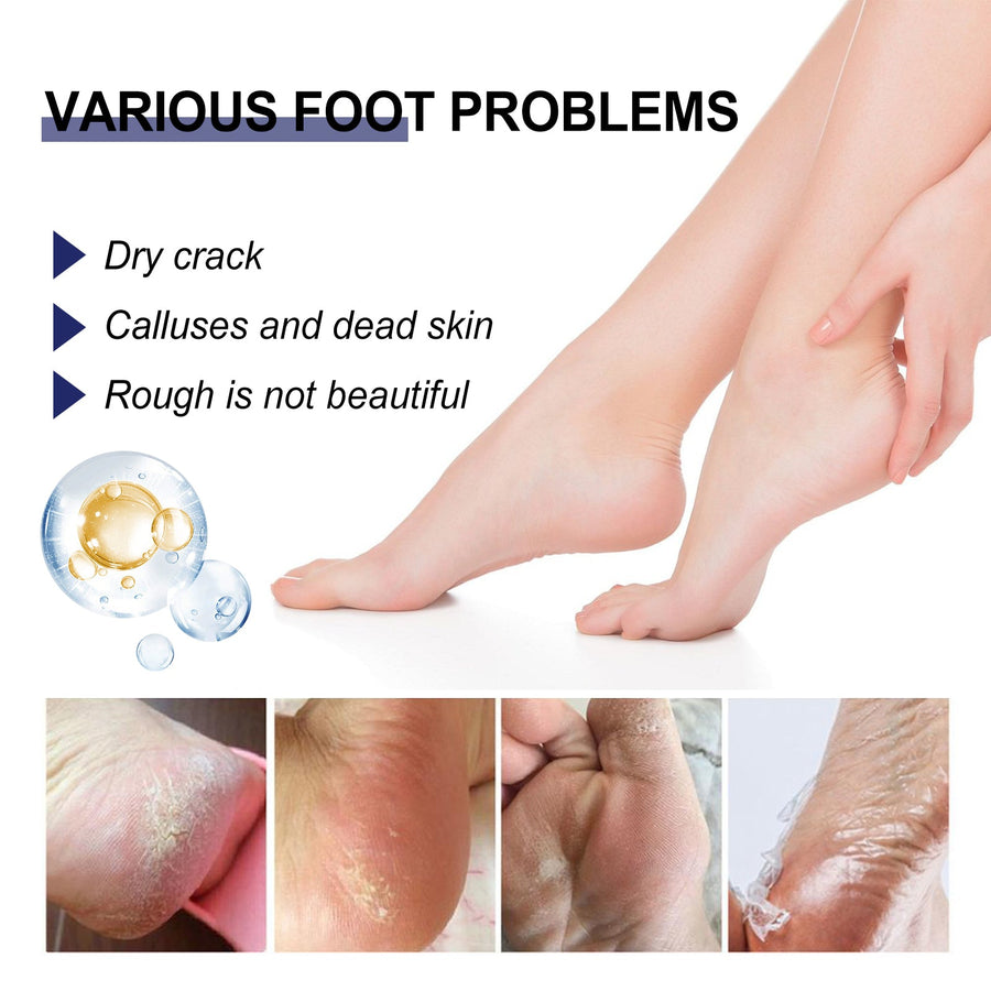 Cracked Heel Ointment – Active Regeneration with Panthenol