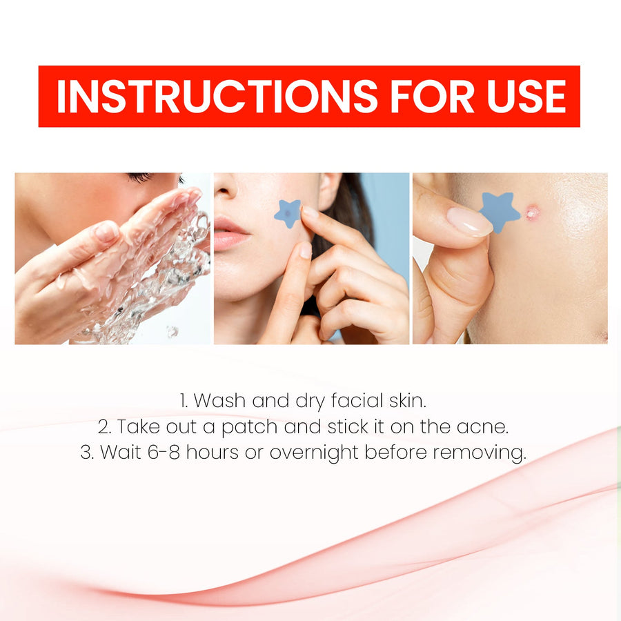 Star Hydrocolloid Pimple Patches, 200-Count Acne Set