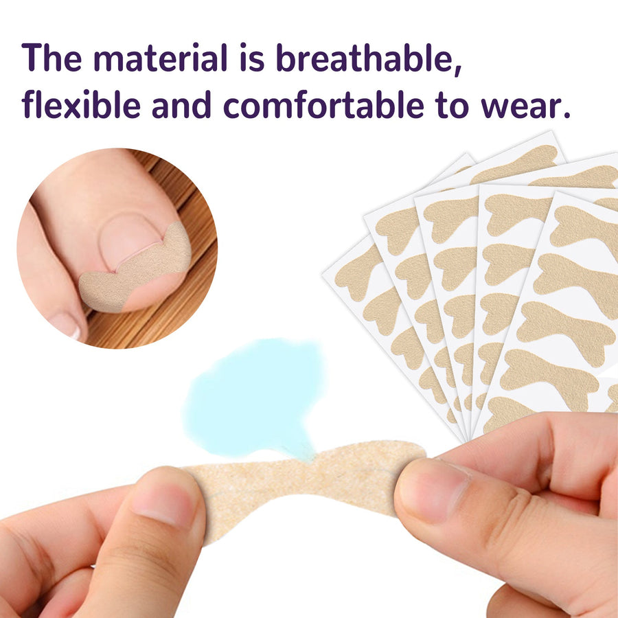 Elastic Toenail Correction Patch for Ingrown Nail Relief