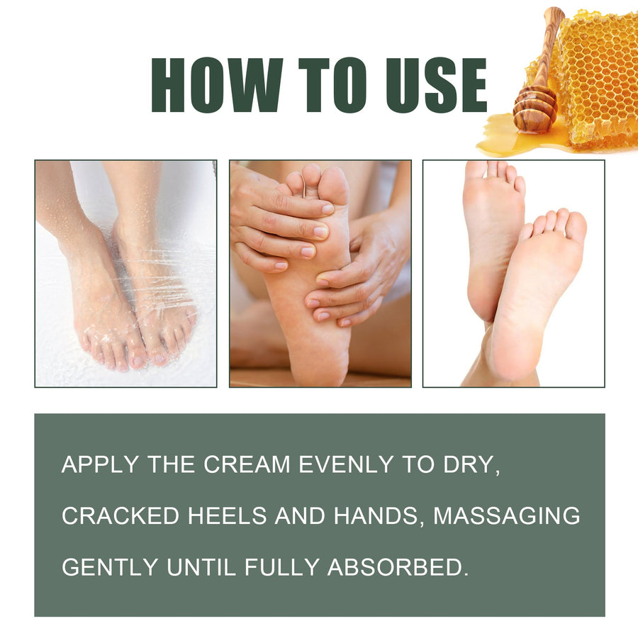 Cracked Heel Cream for Softer Hands, Feet & Calluses