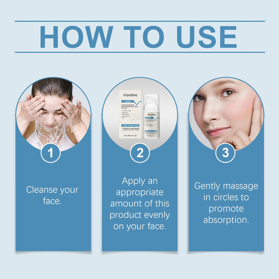 Soothing Anti-Acne Repair Lotion for Oily, Dry Skin