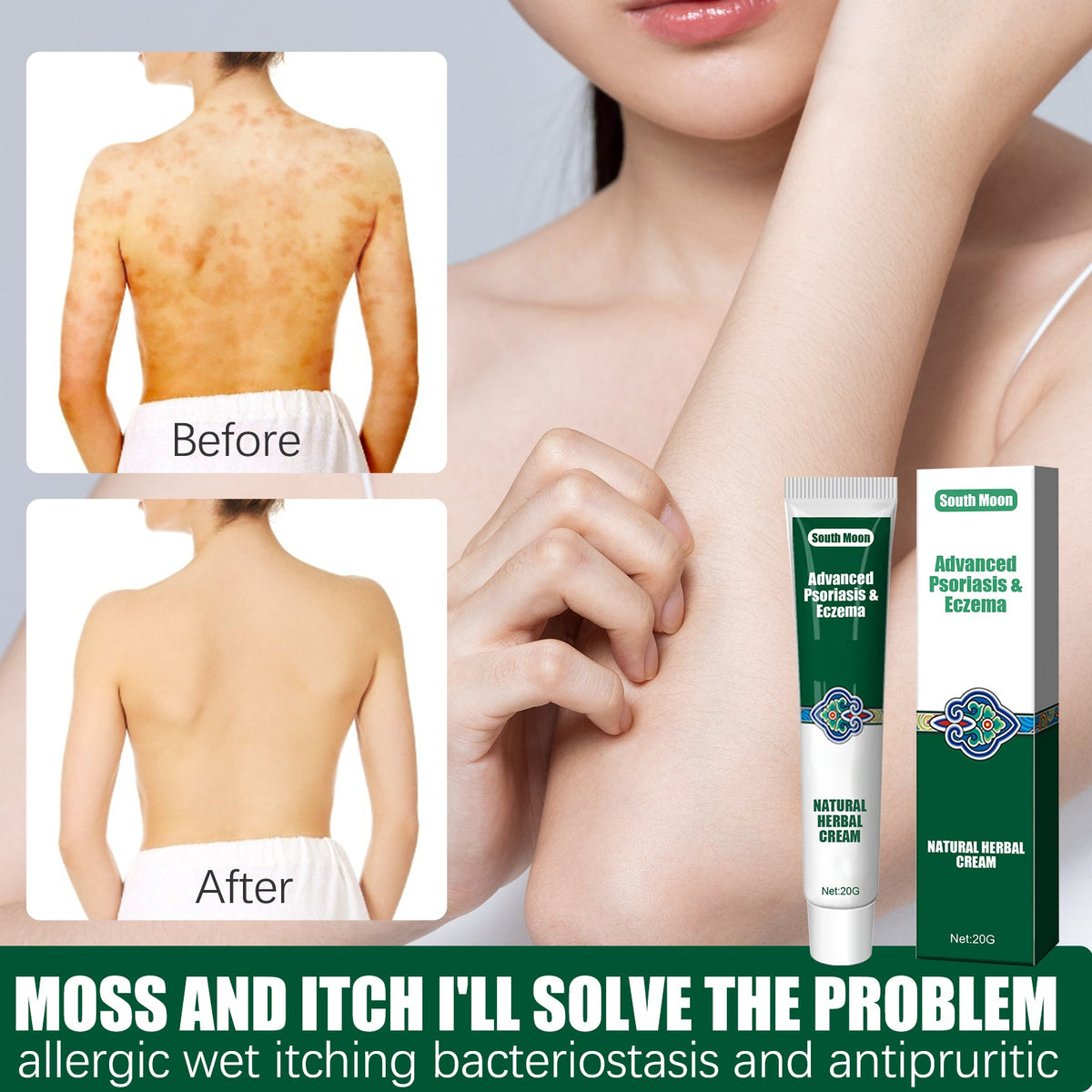 Herbal Soothing Cream for Dry, Itchy & Irritated Skin