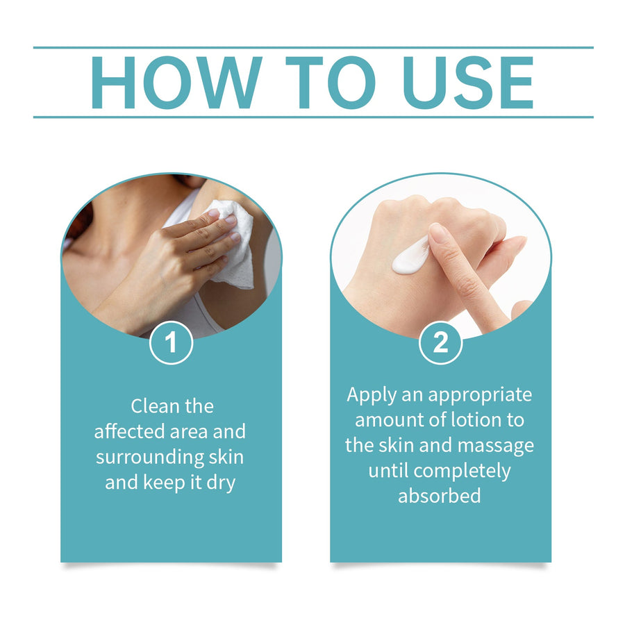 Acanthosis Nigricans Care Set for Even-Looking Skin