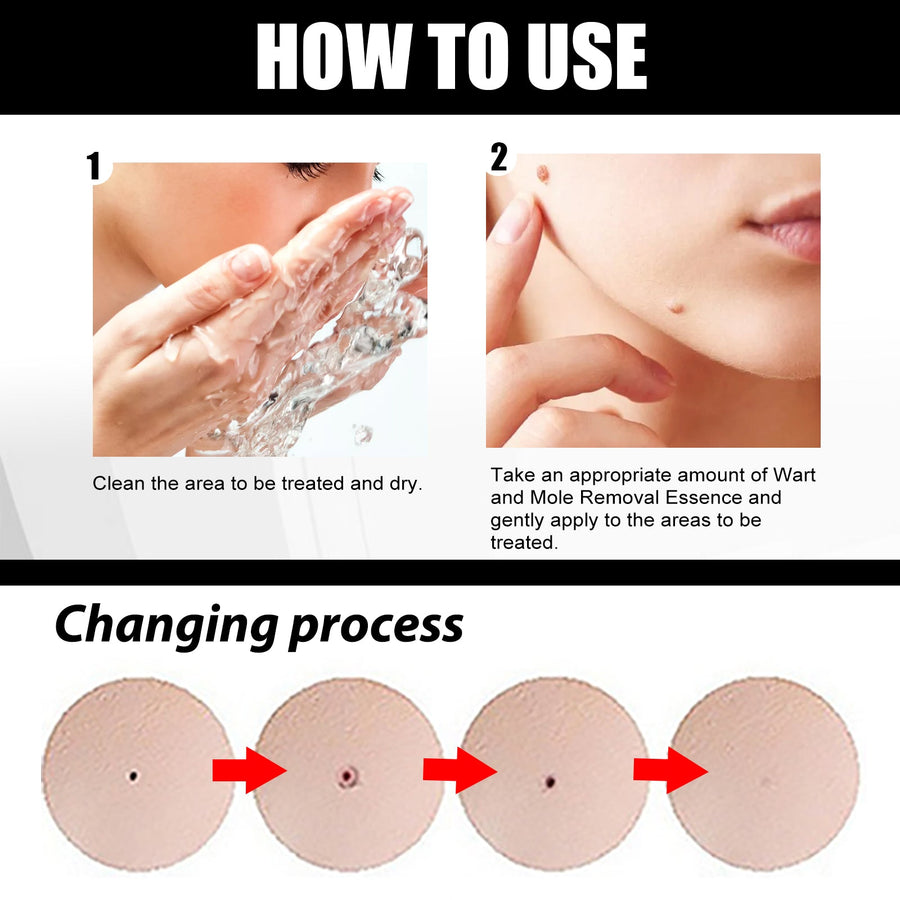 Skin Essence Mole Removal Serum – Smooth Clear Skin
