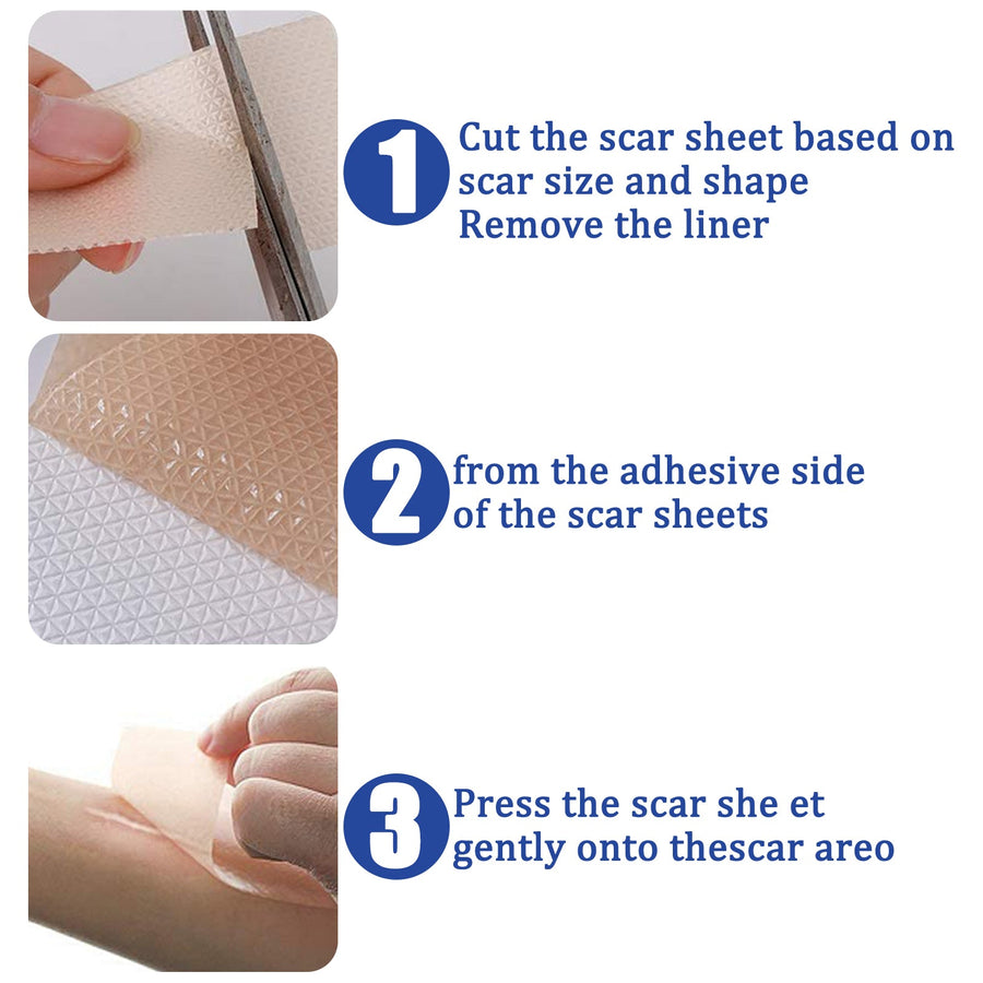 Silicone Scar Sheets for Surgical & Burn Scars