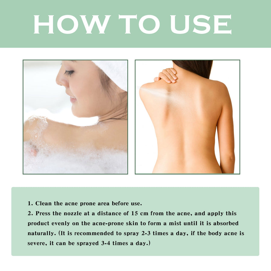 Body Acne Spray for Back, Chest & Shoulder Breakouts